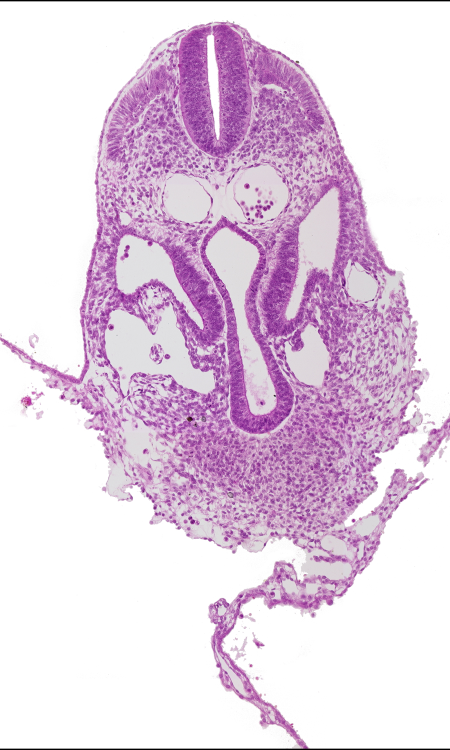 amnion, amnion attachment, amniotic cavity, caudal edge of pericardial cavity, dermatomyotome 6 (C-2), dorsal aorta, extra-embryonic coelom, junction of hepatic and umbilical veins, left umbilical vein, left vitelline (omphalomesenteric) vein, notochord, peritoneal cavity, right umbilical vein, right vitelline (omphalomesenteric) vein, septum transversum