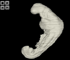 Embryo