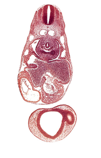 common atrioventricular canal, common cardinal vein, dermatomyotome 7 (C-3), endocardium, epimyocardium, esophagus primordium, intraretinal space (optic vesicle cavity), left atrium, left lung bud, notochord, postcardinal vein, prosencoel (third ventricle), right atrium, sinu-atrial foramen, sinus venosus