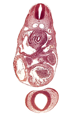 C-3 spinal ganglion primordium, dermatomyotome 7 (C-3), dorsal aorta, endocardium, junction of left common cardinal and left umbilical veins with left sinus horn, junction of right hepatocardiac vein and sinus venosus, nasal disc (olfactory placode), notochord, postcardinal vein, prosencephalon (telencephalic part), prosencoel (third ventricle), trabecular part of left ventricle