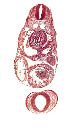 C-3 spinal ganglion primordium, dorsal aorta, left ventricle, nasal disc (olfactory placode), notochord, postcardinal vein, prosencephalon (telencephalic part), prosencoel (third ventricle), sinus venosus, stomach primordium