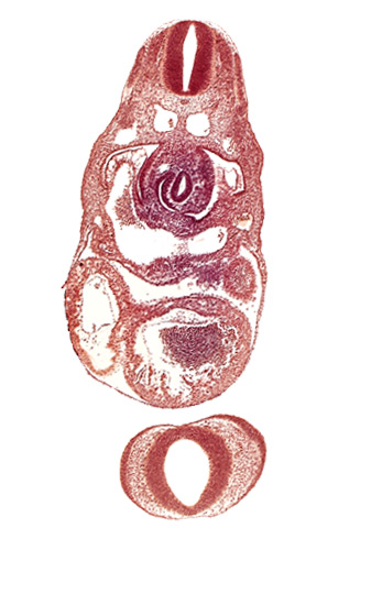 C-3 spinal ganglion primordium, dorsal aorta, junction of left common cardinal vein and sinus venosus, left ventricle, nasal disc (olfactory placode), notochord, postcardinal vein, prosencephalon (telencephalic part), prosencoel (third ventricle), sinus venosus, stomach primordium