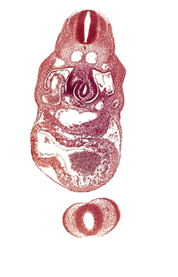 C-4 spinal ganglion primordium, anterior interventricular sulcus, cephalic edge of upper limb bud, dermatomyotome 8 (C-4), dorsal aorta, endocardium, epimyocardium, interventricular foramen, junction of hepatocardiac and umbilical veins, left umbilical vein, nasal disc (olfactory placode), notochord, postcardinal vein, prosencoel (third ventricle), stomach primordium, telencephalon medium, trabecular part of left ventricle