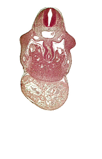 alar plate(s), basal plate, coelomic cavity, hepatic sinusoid, junction of duodenum and stomach primordia, left ventricle, pericardial cavity, postcardinal vein, right umbilical vein, right ventricle: endocardium, right ventricle: epimyocardium, septum transversum, specialized coelomic wall, upper limb bud