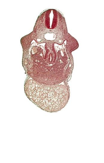 alar plate(s), basal plate, coelomic cavity, common aorta, duodenum primordium, hepatic lamina(e), hepatic sinusoid, notochord, postcardinal vein, septum transversum, specialized coelomic wall, upper limb bud