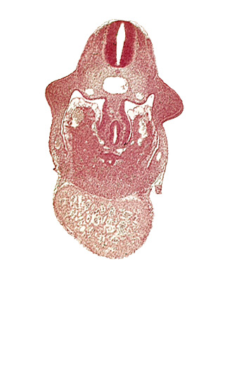 alar plate(s), basal plate, coelomic cavity, common aorta, common ventricle, dermatomyotome 9 (C-5), dorsal pancreatic bud, duodenum primordium, hepatic lamina(e), hepatocardiac vein, postcardinal vein, septum transversum, specialized coelomic wall, upper limb bud