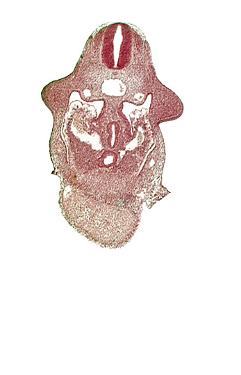 C-5 spinal ganglion primordium, amnion attachment, aorta, caudal edge of common ventricle, dermatomyotome 9 (C-5), dorsal pancreatic bud, duodenum primordium, hepatic antrum, left hepatocardiac vein, left umbilical vein, notochord, pericardial cavity, right hepatocardiac vein, septum transversum, specialized coelomic wall, upper limb bud