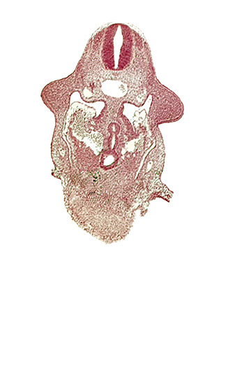 C-5 spinal ganglion primordium, amnion attachment, aorta, caudal edge of common ventricle, dermatomyotome 9 (C-5), dorsal pancreatic bud, hepatic antrum, left hepatocardiac vein, postcardinal vein, right hepatocardiac vein, septum transversum, specialized coelomic wall, upper limb bud