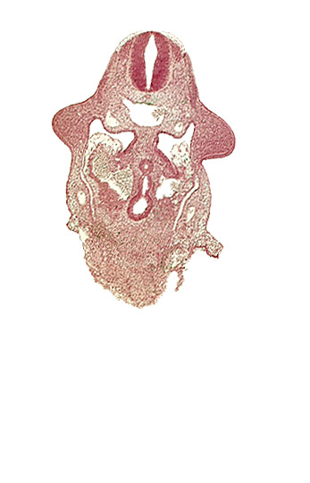 amnion attachment, aorta, caudal edge of common ventricle, dermatomyotome 9 (C-5), dorsal intersegmental artery, dorsal pancreatic bud, hepatic antrum, left hepatocardiac vein, notochord, postcardinal vein, right hepatocardiac vein, specialized coelomic wall, upper limb bud