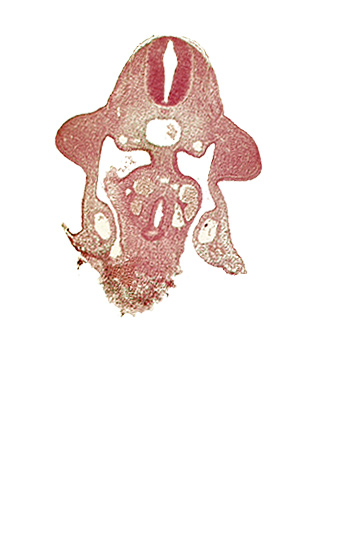 C-6 spinal ganglion primordium, amnion attachment, aorta, apical ectodermal ridge, coelomic cavity, communication of coelomic cavity with extra-embryonic coelom, dermatomyotome 10 (C-6), junction of hepatocardiac and right vitelline veins, left vitelline (omphalomesenteric) vein, neural tube, notochord, sclerotome, upper limb bud, ventral pancreatic bud