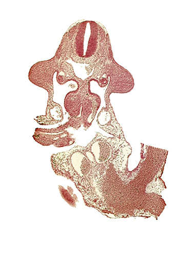 allantois, aorta, cephalic end of mesonephros, common umbilical vein, communication between coelomic cavity and extra-embryonic coelom, dermatomyotome 10 (C-6), edge of caudal eminence, intersegmental artery, left umbilical artery, left umbilical vein, left vitelline (omphalomesenteric) vein, midgut, omphaloenteric duct, postcardinal vein, subcardinal vein, upper limb bud