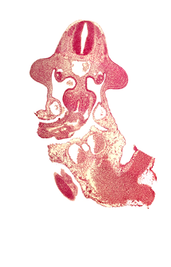 C-6 spinal ganglion primordium, allantois, aorta, cephalic end of mesonephros, cephalic limb bud mesenchyme, common umbilical vein, dermatomyotome 10 (C-6), edge of somite 32 (S-3), gonadal epithelium, left umbilical artery, left umbilical vein, marginal layer, mesonephric vesicle(s), midgut, omphaloenteric duct, origin of intersegmental artery, origin of vitelline (omphalomesenteric) artery, postcardinal vein, roof plate, subcardinal vein, sulcus limitans, vitelline (omphalomesenteric) vein