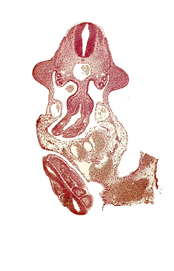 allantois, aorta, coelomic cavity, dermatomyotome 11 (C-7), left umbilical artery, left umbilical vein, marginal layer, mesentery proper, neural tube, paraxial mesoderm, right umbilical artery, right umbilical vein, roof plate, somite 30 (S-1), somite 31 (S-2), somite 32 (S-3), sulcus limitans, upper limb bud