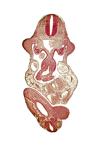 C-7 spinal ganglion primordium, allantois, aorta, caudal eminence, cloaca, dermatomyotome 11 (C-7), left umbilical artery, left umbilical vein, lower limb bud, mesonephric duct, mesonephric tubule(s), neural canal, notochord, origin of primary intestinal plexus artery, postcardinal vein, somite 29 (L-5), somite 30 (S-1), somite 31 (S-2), upper limb bud