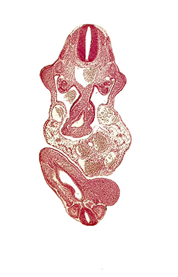 allantois, aorta, caudal eminence, cloaca, dermatomyotome 11 (C-7), junction of midgut and omphalo-enteric duct, lower limb bud, mesonephric duct, neural canal, postcardinal vein, somite 29 (L-5), somite 30 (S-1), upper limb bud