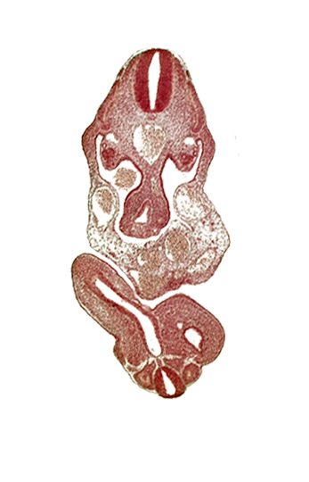 C-7 spinal ganglion primordium, cloaca, dermatomyotome 11 (C-7), dermatomyotome 12 (C-8), junction of cloaca and mesonephric duct, mesonephric duct, sclerotome, somite 28 (L-4), somite 29 (L-5)