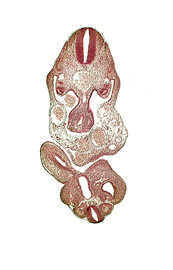 C-8 spinal ganglion primordium, caudal edge of upper limb bud, caudal eminence, cloaca, cloacal membrane, coelom, dermatomyotome 12 (C-8), left umbilical artery, left umbilical vein, lower limb bud, mesonephric duct, mesonephric vesicle(s), notochord, origin of primary intestinal plexus artery, right umbilical vein, somite 28 (L-4), tail gut