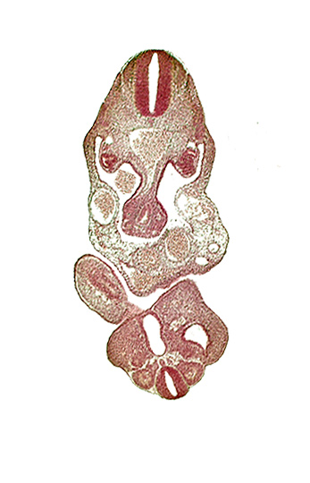 caudal eminence, cloaca, cloacal membrane, coelom, dermatomyotome 12 (C-8), left umbilical artery, left umbilical vein, lower limb bud, notochord, primary intestinal plexus artery, right umbilical vein, somite 28 (L-4)