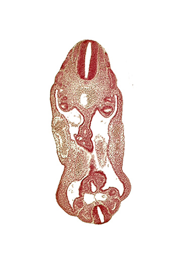 aorta, coelom, dermatomyotome 14 (T-2), dermatomyotome 15 (T-3), dermatomyotome 26 (L-2), hindgut, left common iliac artery, mesentery, mesonephric duct, mesonephric vesicle(s), neural canal, neural tube, right common iliac artery, sclerotome