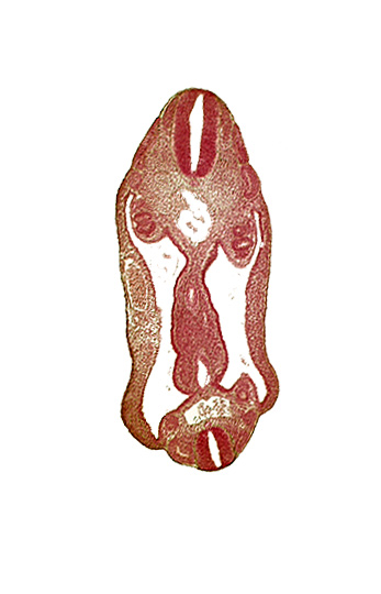 aorta, aortic bifurcation, coelom, dermatomyotome 15 (T-3), dermatomyotome 16 (T-4), dermatomyotome 26 (L-2), hindgut, mesentery, neural tube, notochord