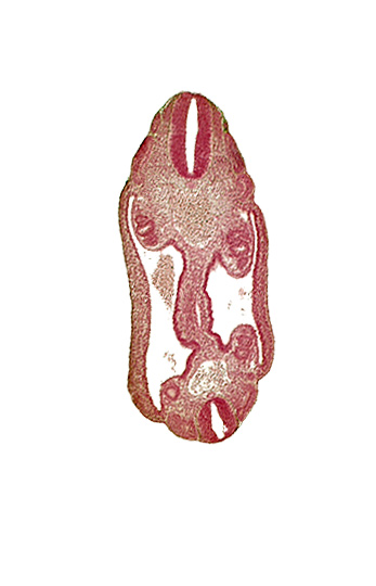 aorta, coelom, dermatomyotome 16 (T-4), dermatomyotome 17 (T-5), dermatomyotome 25 (L-1), mesonephric duct, mesothelium, neural tube, notochord, sclerotome, somatic mesoderm, splanchnic mesoderm