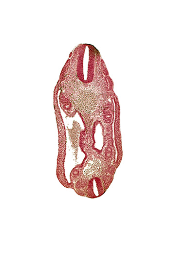 aorta, coelom, dermatomyotome 16 (T-4), dermatomyotome 17 (T-5), dermatomyotome 24 (T-12), dermatomyotome 25 (L-1), lateral body wall, mesonephric vesicle(s), mesothelium, neural tube, notochord, roof plate of neural tube, somatic mesoderm, splanchnic mesoderm