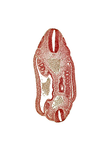 aorta, dermatomyotome 16 (T-4), dermatomyotome 17 (T-5), dermatomyotome 18 (T-6), dermatomyotome 24 (T-12), dermatomyotome 25 (L-1), lateral body wall, mesonephric ridge, mesonephric vesicle(s), neural tube, roof plate of neural tube