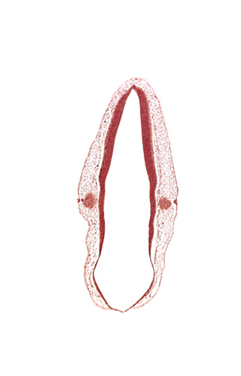 alar plate of rhombencephalon, cephalic edge of otic vesicle, ectodermal tag of otic vesicle, rhombencoel (fourth ventricle), roof plate of rhombencephalon