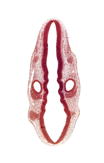 dermatomyotome 1 (O-1), middle dural venous plexus, primordium of facial and vestibulocochlear nerves (CN VII and CN VIII), primordium of glossopharyngeal nerve (CN IX), rhombencoel (fourth ventricle), rhombomere 5, rhombomere 6, rhombomere 7, root of trigeminal nerve (CN V)