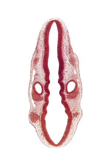 dermatomyotome 1 (O-1), posterior dural venous plexus, primordium of facial and vestibulocochlear nerves (CN VII and CN VIII), primordium of vagus nerve (CN X), rhombencoel (fourth ventricle), rhombomere 4, rhombomere 5, rhombomere 6, rhombomere 7, root of trigeminal nerve (CN V)