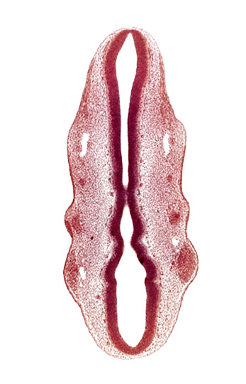 dermatomyotome 2 (O-2) , primary head vein, primordium of facial nerve (CN VII), primordium of glossopharyngeal nerve (CN IX), primordium of trigeminal nerve (CN V), rhombomere 2, rhombomere 4