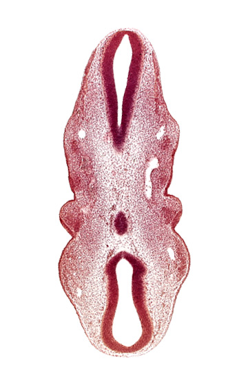 cephalic edge of dorsal aorta