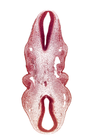 caudal edge(s) of rhombencephalon, dermatomyotome 2 (O-2) , dermatomyotome 3 (O-3) , dorsal aorta, primary head vein, primordium of trigeminal nerve (CN V)