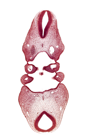 dorsal aorta (aortic arch 4), internal carotid artery, notochord, region of cervical flexure, region of mesencephalic (cephalic) flexure, sulcus limitans