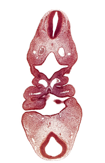 C-1 spinal ganglion primordium, adenohypophysial pouch, anterior dural venous plexus, cervical sinus, dermatomyotome 5 (C-1), epicardial ridge, epipharyngeal placode 4, internal carotid artery, mesencephalon, notochord, pharyngeal arch 3, pharyngeal arch 4, pharyngeal pouch 1, pharyngeal pouch 2, pharynx primordium, precardinal vein