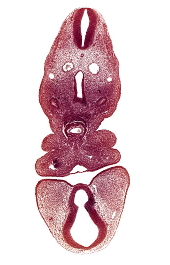 cephalic extent of pericardial cavity, dermatomyotome 5 (C-1), dorsal aorta, dorsal thalamus (diencephalon), internal carotid artery, mandibulary vein, maxillary prominence of pharyngeal arch 1, pharyngeal arch 2, pharyngeal groove 1, precardinal vein, prosencoel (third ventricle), truncus arteriosus, ventral pharyngeal vein, ventral thalamus (diencephalon)