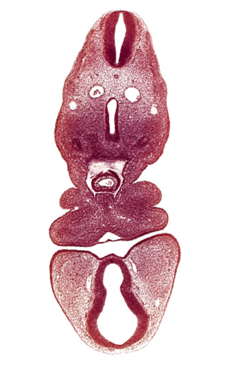 caudal edge of ultimopharyngeal pouch, caudal part of foregut, dermatomyotome 5 (C-1), dorsal aorta, dorsal thalamus (diencephalon), internal carotid artery, maxillary prominence of pharyngeal arch 1, oral fissure, pericardial cavity, pharyngeal arch 2, pharyngeal groove 1, precardinal vein, prosencoel (third ventricle), truncus arteriosus, ventral thalamus (diencephalon)