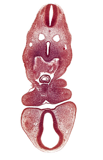 C-1 spinal ganglion primordium, anterior dural vein, cephalic part of left atrium, dermatomyotome 5 (C-1), dorsal thalamus (diencephalon), mandibular prominence of pharyngeal arch 1, oral fissure, pericardial cavity, precardinal vein, prosencoel (third ventricle), truncus arteriosus, ventral thalamus (diencephalon)