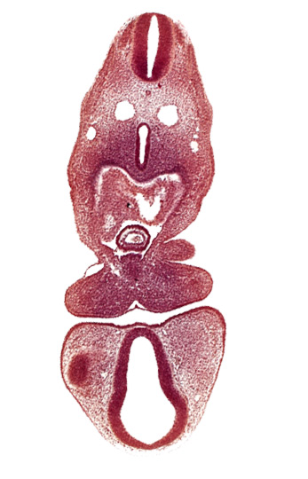 C-1 spinal ganglion primordium, anterior dural vein, caudal edge of optic vesicle, dermatomyotome 5 (C-1), dorsal thalamus (diencephalon), left atrium, mandibular prominence of pharyngeal arch 1, oral fissure, pericardial cavity, prosencoel (third ventricle), separation artifact, truncus arteriosus