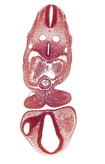 C-1 spinal ganglion primordium, dermatomyotome 5 (C-1), dermatomyotome 6 (C-2), dorsal aorta, dorsal thalamus (diencephalon), left atrium, mandibular prominence of pharyngeal arch 1, optic vesicle, pericardial cavity, primary interatrial septum (septum primum), prosencoel (third ventricle), tracheo-esophageal tube, truncus arteriosus