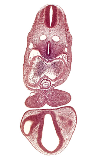 caudal edge of left optic vesicle, chiasmatic part of diencephalon, dermatomyotome 5 (C-1), dermatomyotome 6 (C-2), dorsal aorta, endocardium, epicardial ridge, intraretinal space (optic vesicle cavity), left atrium, mandibular prominence of pharyngeal arch 1, marginal layer of spinal cord, median mandibular groove, notochord, optic stalk (CN II), pericardial cavity, precardinal vein, prosencoel (third ventricle), right atrium, separation artifact, tracheo-esophageal tube, truncus arteriosus, ventral thalamus