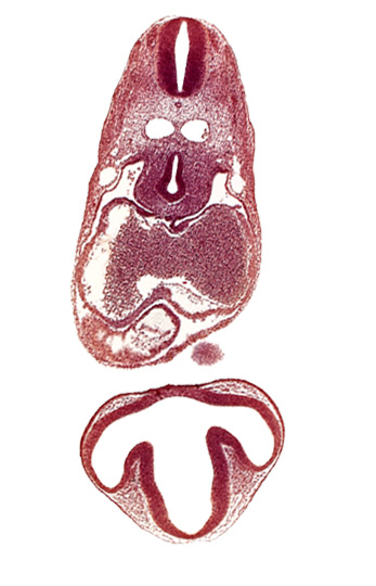 C-2 spinal ganglion primordium, caudal edge of mandibular prominence of pharyngeal arch 1, communication of prosencoel (third ventricle) with optic vesicle, dermatomyotome 6 (C-2), dorsal aorta, dorsal thalamus, epithalamus, left atrium, mesocardium, notochord, optic vesicle, pericardial cavity, precardinal vein, prosencoel (third ventricle), right atrial wall, right ventricle, tracheo-esophageal tube, ventral thalamus