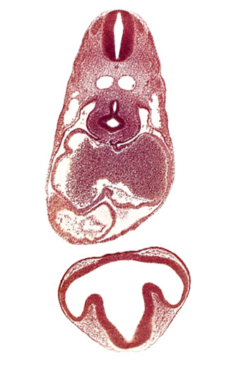 dermatomyotome 6 (C-2), diencephalon, dorsal aorta, esophagus primordium, intraretinal space (optic vesicle cavity), junction of postcardinal and precardinal veins, lens disc, nucleated red blood cells in left atrium, pericardial cavity, primary interatrial septum (septum primum), right atrium, sinus venosus, trachea primordium