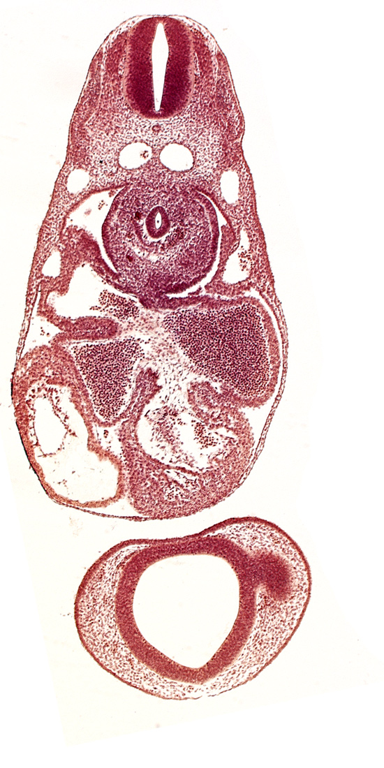 C-3 spinal ganglion primordium, caudal edge of optic vesicle, common atrioventricular canal (isthmus), common cardinal vein, dermatomyotome 7 (C-3), dorsal aorta, endocardium, epimyocardium, esophagus primordium, interventricular sulcus, left atrium, notochord, postcardinal vein, prosencephalon (telencephalic part), prosencoel (third ventricle), sinu-atrial foramen, sinus venosus, trabecular part of left ventricle