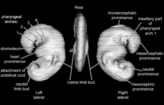 Embryo 