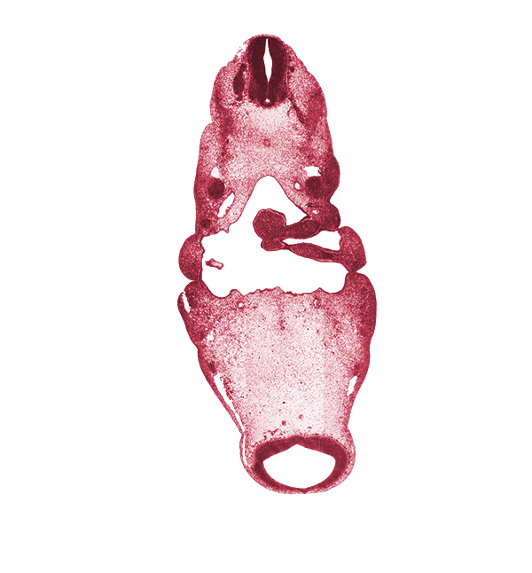 C-1 spinal nerve, cephalic part of notochord, dorsal aorta, hypopharyngeal eminence of tongue, inferior ganglion of glossopharyngeal nerve (CN IX), inferior ganglion of vagus nerve (CN X), internal carotid artery, maxillary nerve (CN V₂), mesencoel (cerebral aqueduct), neural arch primordium, notochord, ophthalmic nerve (CN V₁), pharyngeal arch 2, pharyngeal arch 3, pharyngeal groove 1, pharyngeal groove 2, pharyngeal pouch 1, pharynx, posterior cerebral artery, precardinal vein, spinal accessory nerve (CN XI), stem of anterior dural venous plexus, tectum of mesencephalon, tegmentum of mesencephalon