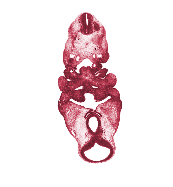 C-2 spinal ganglion, adenohypophysial pouch, aortic arch 3, cervical sinus, diencephalon, diencoel (third ventricle), dorsal aorta, junction of diencephalon and mesencephalon, lateral lingual swelling of tongue, mamillary recess, mandibular prominence of pharyngeal arch 1, maxillary prominence of pharyngeal arch 1, mesencephalon (M1), neural arch primordium, neural canal, notochord, pharyngeal arch 3, pharyngeal groove 1, pharyngeal groove 2, pharyngeal groove 3, pharyngeal groove 4, pharyngeal pouch 1, pharyngeal pouch 2, precardinal vein, presumptive laryngeal pharynx, presumptive nasopharynx, primordial maxillary vein, stem of anterior dural venous plexus, thyroglossal duct, tuberculum impar