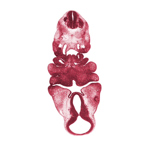 C-2 spinal ganglion, adenohypophysial pouch, aortic arch 3, aortic arch 4, bilobed thyroid gland, cervical sinus, diencephalon, diencoel (third ventricle), dorsal aorta, dorsal thalamus, edge of optic cup, inferior ganglion of vagus nerve (CN X), junction of diencoel (third ventricle) and mesencoel, mamillary recess, maxillary prominence of pharyngeal arch 1, median mandibular groove, mesencoel, neural arch primordium, notochord, oral fissure, pharyngeal arch 1, pharyngeal arch 2, pharyngeal arch 3, pharyngeal arch 4, pharyngeal groove 1, pharyngeal pouch 2, pharyngeal pouch 3, precardinal vein, presumptive nasopharynx, pretectum, primordial maxillary vein, spinal accessory nerve (CN XI)