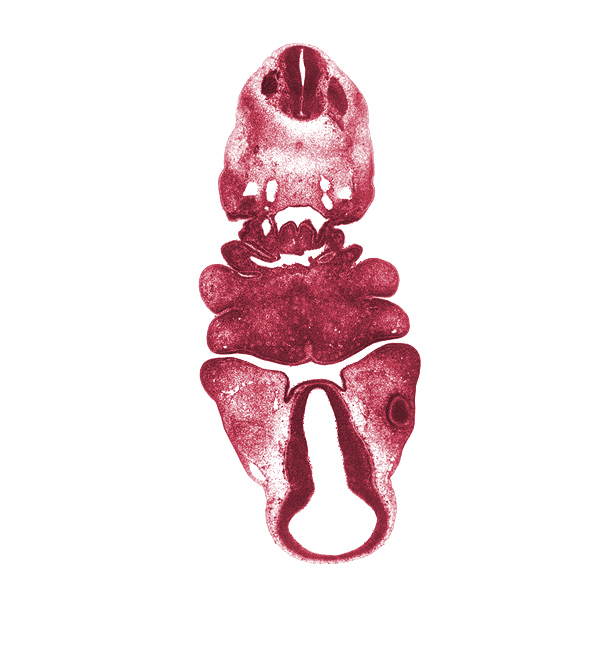 C-2 spinal ganglion, C-2 ventral root, adenohypophysial pouch, aortic arch 3, aortic arch 4, aortic sac, arytenoid swelling, diencoel (third ventricle), dorsal aorta, dorsal thalamus, hypothalamic sulcus, hypothalamus, inferior ganglion of vagus nerve (CN X), lateral lingual swelling of tongue, mandibular prominence of pharyngeal arch 1, maxillary prominence of pharyngeal arch 1, median mandibular groove, neural arch primordium, notochord, optic cup, oral fissure, pharyngeal arch 2, pharyngeal arch 3, pharyngeal arch 4, pharyngeal pouch 3, pretectum, sclerotome, spinal accessory nerve (CN XI), synencephalon, ventral thalamus