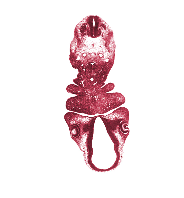 aortic sac, caudal edge of pharyngeal arch 3, cephalic edge of C-3 spinal ganglion, cephalic edge of pericardial cavity, diencephalon, diencoel (third ventricle), dorsal aorta, dorsal thalamus, edge of optic stalk (CN II), external layer of optic cup, internal layer of optic cup, laryngeal condensation, lens vesicle, mandibular prominence of pharyngeal arch 1, notochord, optic cup, optic stalk (CN II), oral fissure, pharyngeal arch 2, pharyngeal groove 1, pharyngeal pouch 4, precardinal vein, pretectum, spinal accessory nerve (CN XI), sulcus medius, synencephalon, ultimopharyngeal pouch, ventral thalamus